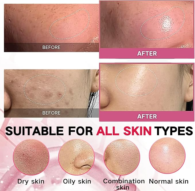 Collagen Jelly Cream – Deep Hydration Face Moisturizer for Firm & Radiant Skin