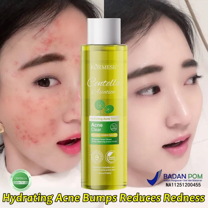 Centella Asiatica Facial Toner – Oil Control Hydrating Toner