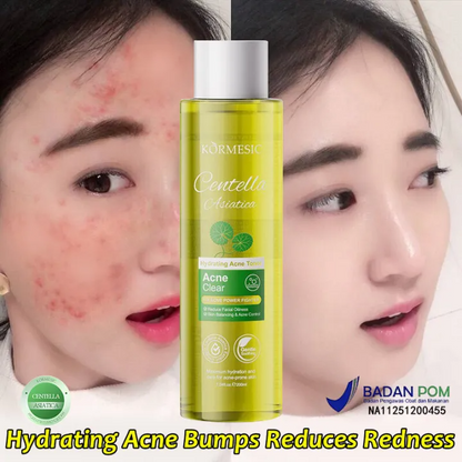 Centella Asiatica Facial Toner – Oil Control Hydrating Toner