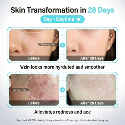 5X Ceramide Hyaluronic Acid Moisturizing Gel for Men & Women