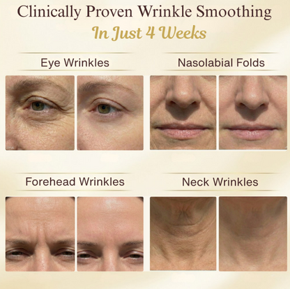 Peptide Collagen Lifting Ampoule – Firming & Anti-Aging Skin Serum