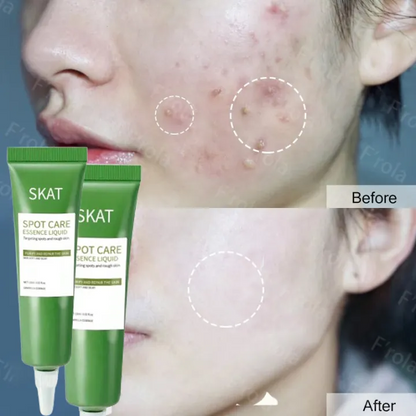 Vitamin B5 Vegan Face Serum & Cream for Oily Skin