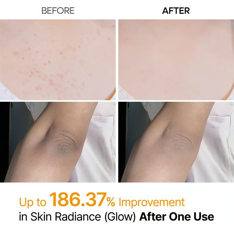Kojic Turmeric Glow Spray – Gentle Exfoliating Brightening Mist