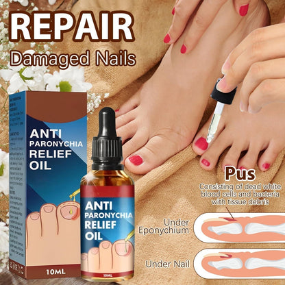 Relief Nail Oil – Extra Strength Care for Discolored & Damaged Nails