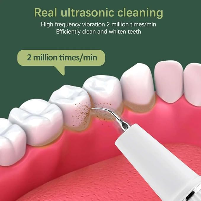 Portable Dental Plaque & Tartar Remover – Rechargeable Tooth Cleaning Tool for Home Use