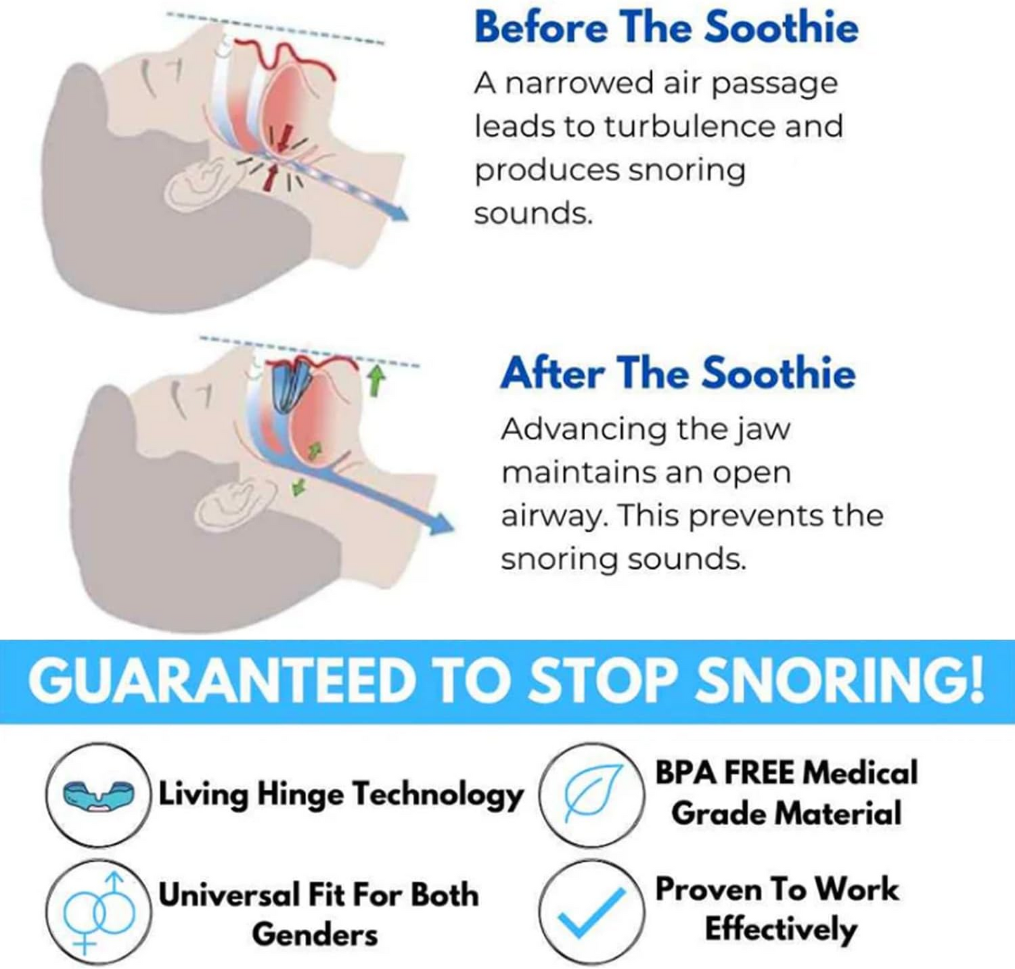 Adjustable Anti-Snoring Mouthpiece Nighttime for Better Sleep