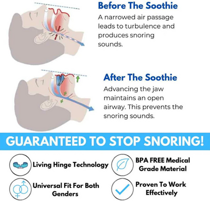 Adjustable Anti-Snoring Mouthpiece Nighttime for Better Sleep