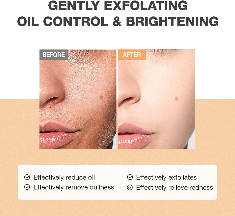 Herbal Salicylic Acid Facial Cleanser Gentle Exfoliating Face Wash