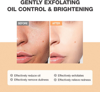 Herbal Salicylic Acid Facial Cleanser Gentle Exfoliating Face Wash