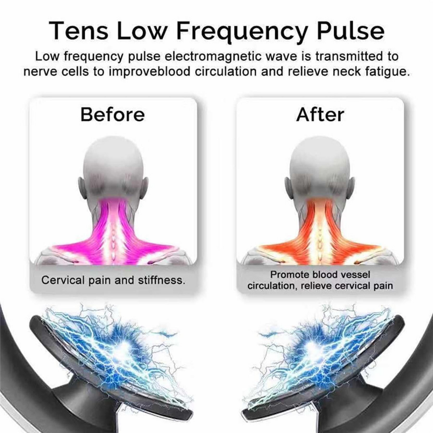 Intelligent Electric Neck & Body Massager – Wireless Vibration Therapy with Music Function