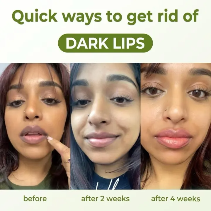 Moisturizing Lip Care Balm – Nourishing Repair & Smooth Lip Lines