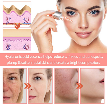 5 in 1 Hyaluronic Acid & Vitamin C Facial Serum