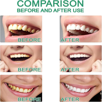 Niacinamide Toothpaste – Whiten, Strengthen & Refresh Naturally