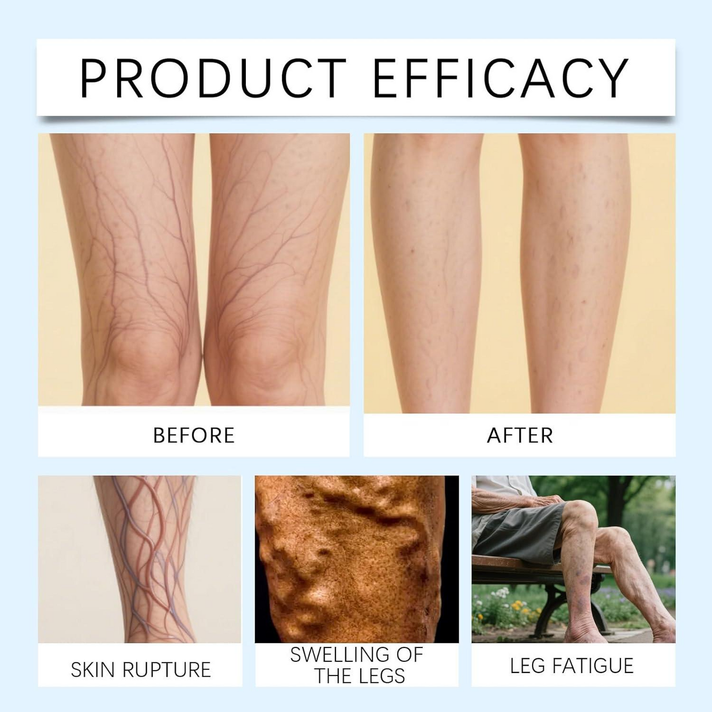 Gentle Moisturizing Leg Care Cream – Hydrating & Comforting Skin Care