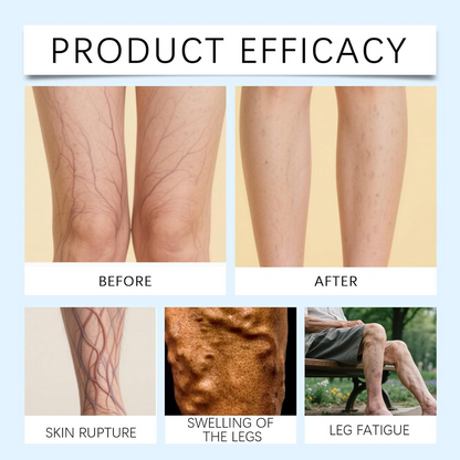 Gentle Moisturizing Leg Care Cream – Hydrating & Comforting Skin Care