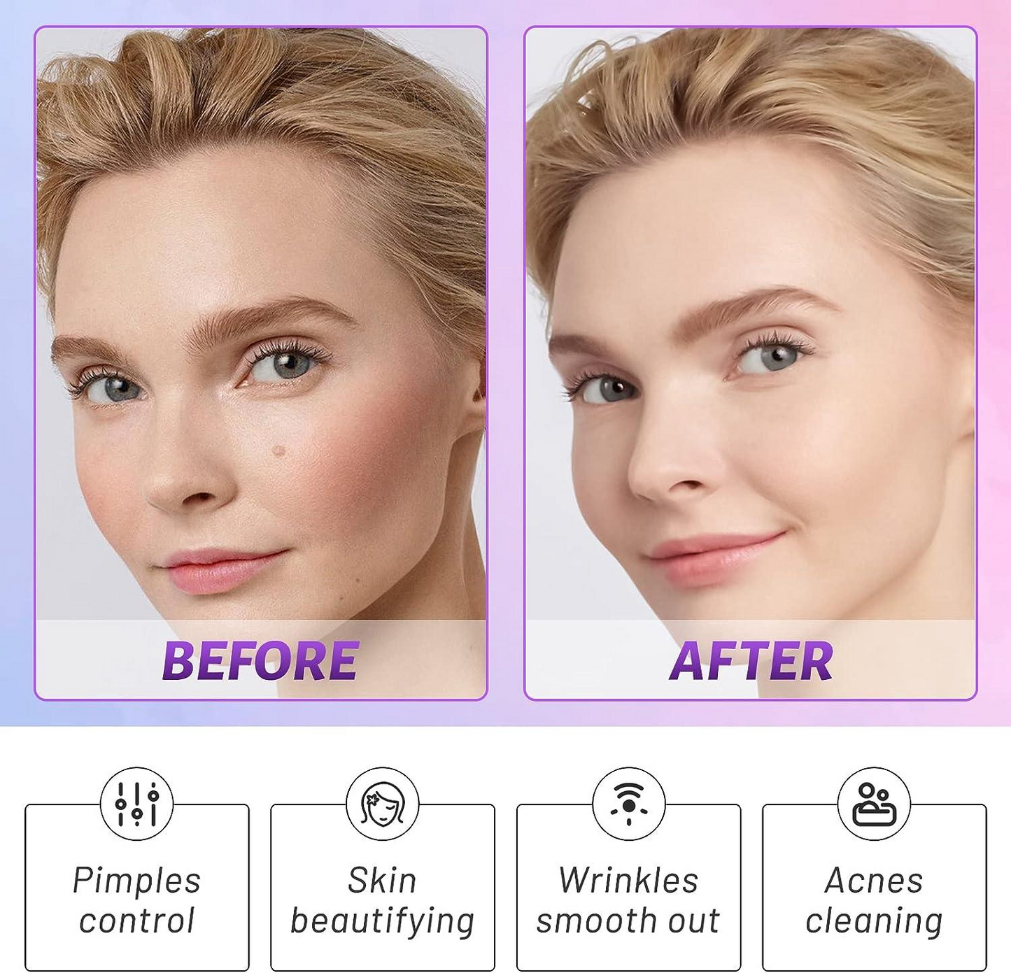 Portable High Frequency Facial Electric Skin Care & Scalp Massage