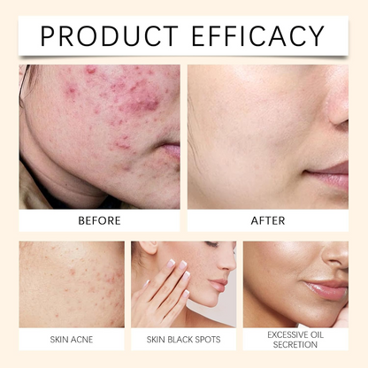 Hydrating Facial Serum Spray – Moisturizing & Soothing Skin Care Mist