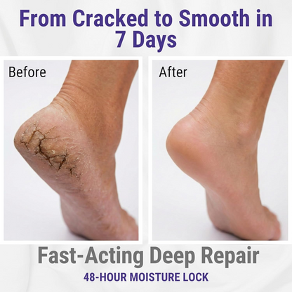 Tea Tree Repair Cream – Intensive Care for Dry & Cracked Skin