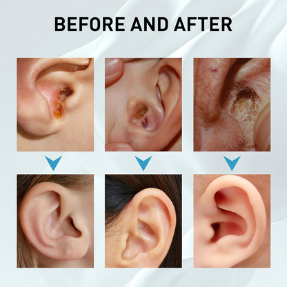 Tinnitus Relief Ear Drops – Earwax Cleanse & Soothing Care