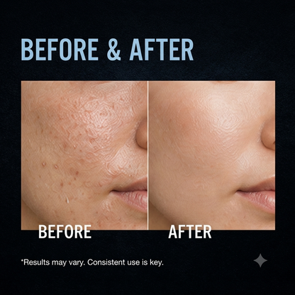 Exfoliating Facial Serum – Gentle Skin Smoothing & Brightening Essence
