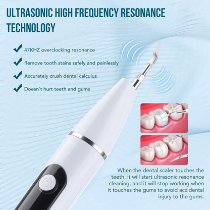 Portable Dental Plaque & Tartar Remover – Rechargeable Tooth Cleaning Tool for Home Use