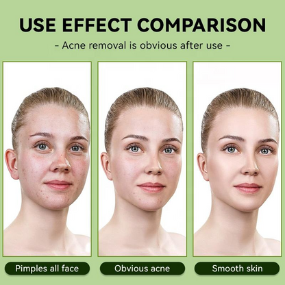 Centella Asiatica Facial Toner – Oil Control Hydrating Toner