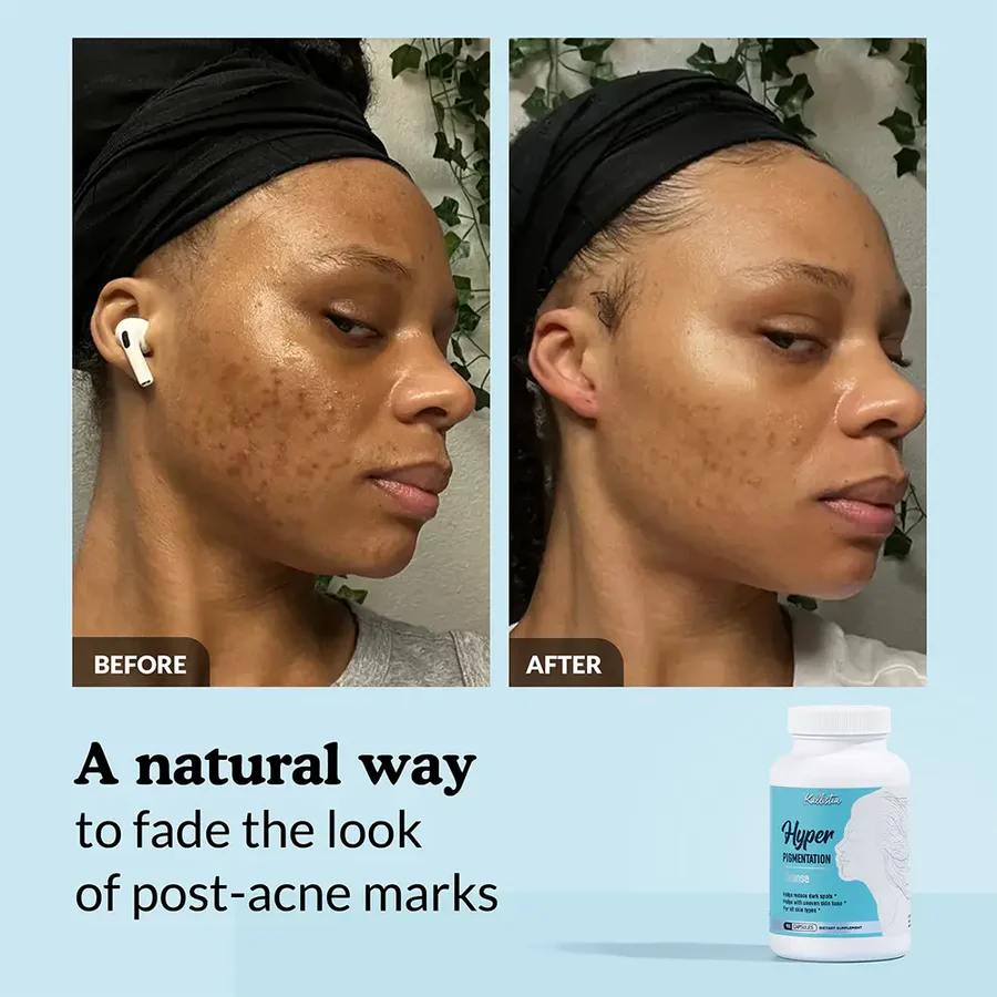 Vegan Skin Care Capsules – Daily Dietary Supplement for Healthy-Looking Skin