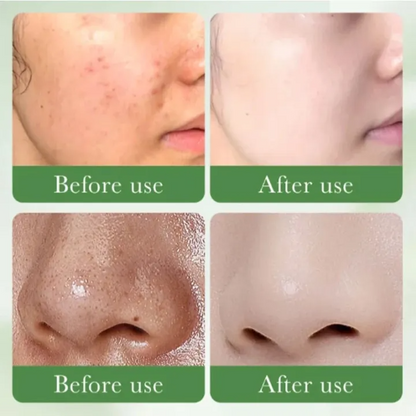 Centella Asiatica Facial Toner – Oil Control Hydrating Toner