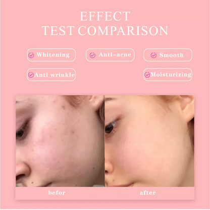 5 in 1 Hyaluronic Acid & Vitamin C Facial Serum