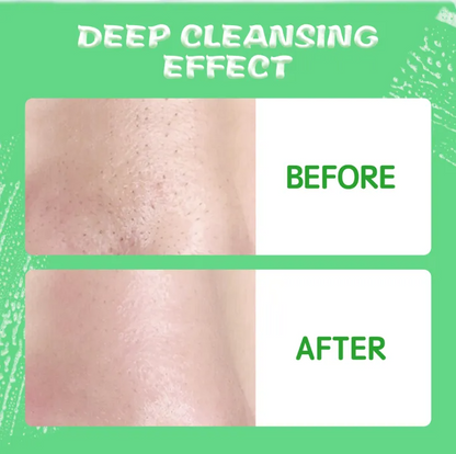 Hyaluronic Acid & BHA Facial Cleanser Korean Face Wash