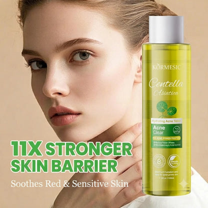 Centella Asiatica Facial Toner – Oil Control Hydrating Toner
