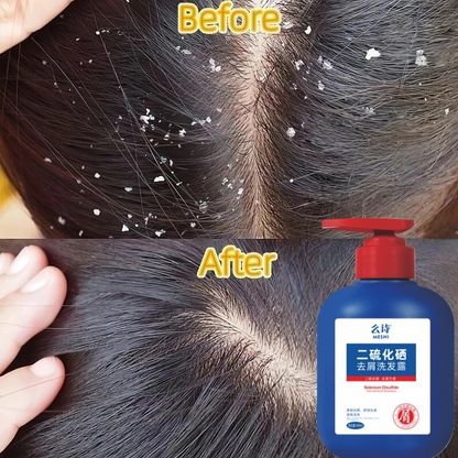 Anti Dandruff Shampoo –  Japanese scalp care formula