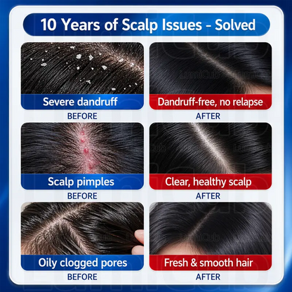Anti Dandruff Shampoo – Scalp Care & Smooth Hair Cleansing Formula