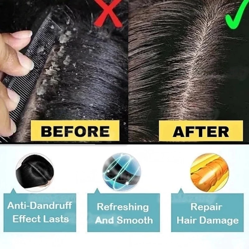 Anti Dandruff Shampoo –  Japanese scalp care formula