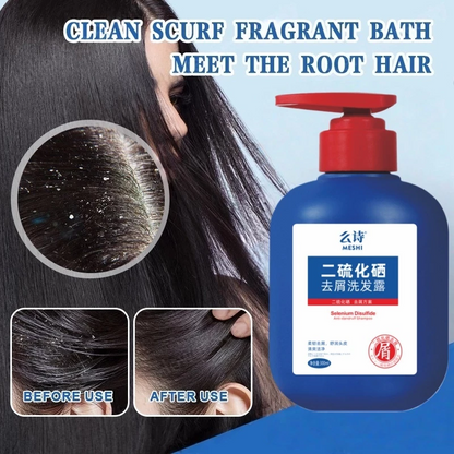 Anti Dandruff Shampoo –  Japanese scalp care formula
