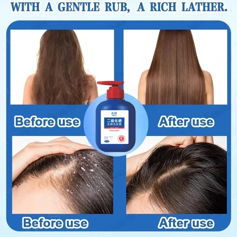 Anti Dandruff Shampoo –  Japanese scalp care formula