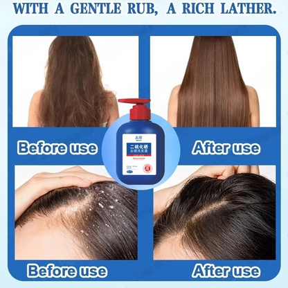 Anti Dandruff Shampoo –  Japanese scalp care formula