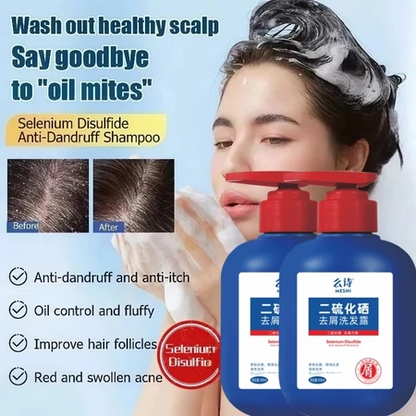 Anti Dandruff Shampoo –  Japanese scalp care formula
