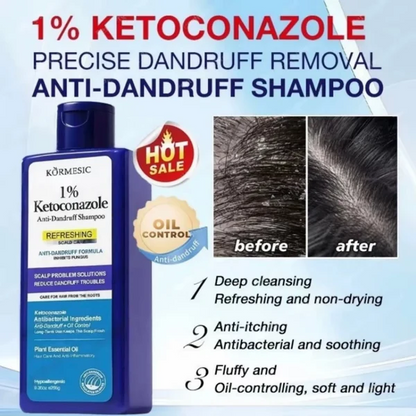 Anti Dandruff Shampoo – Scalp Care & Smooth Hair Cleansing Formula