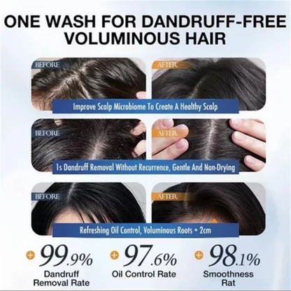 Anti Dandruff Shampoo – Scalp Care & Smooth Hair Cleansing Formula