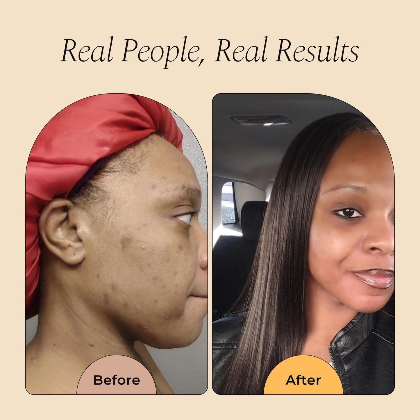 Turmeric & Body Care Oil