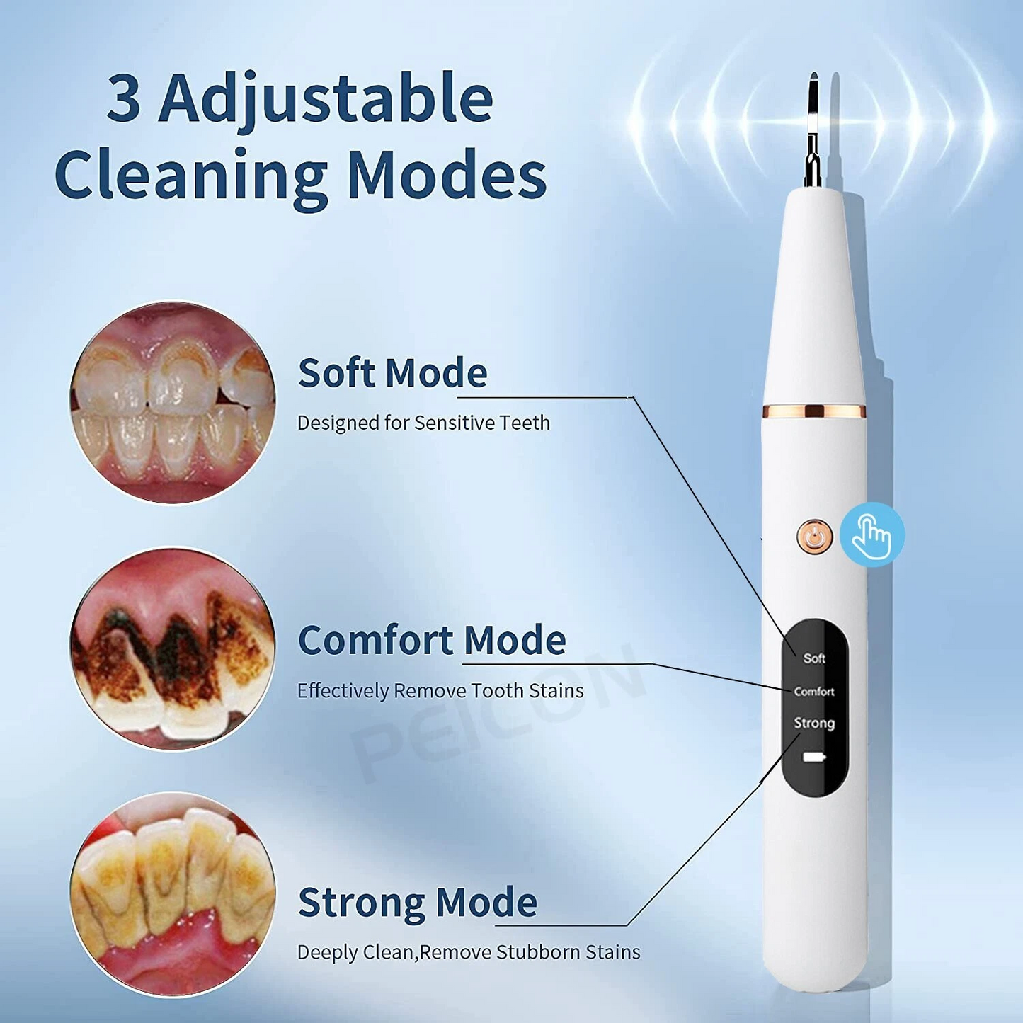 Portable Dental Plaque & Tartar Remover – Rechargeable Tooth Cleaning Tool for Home Use