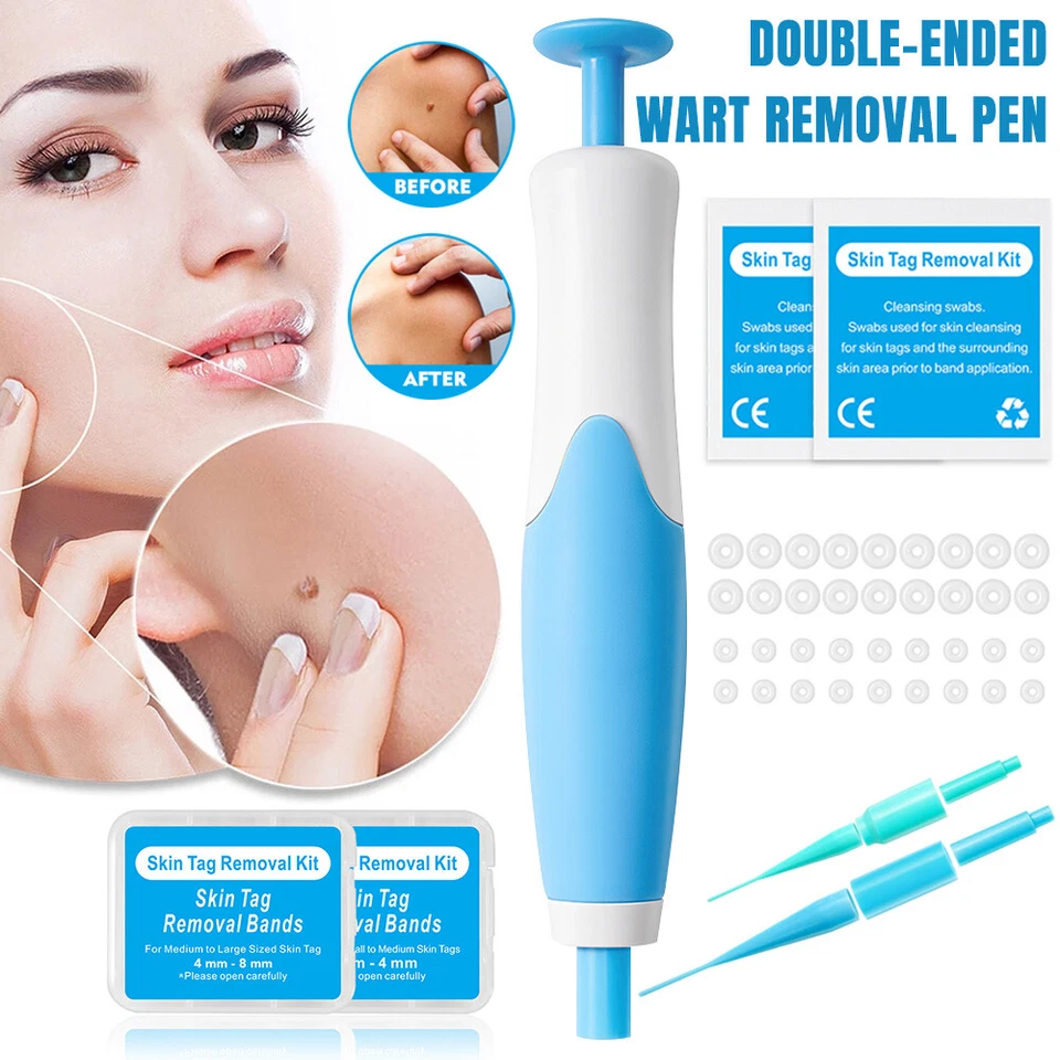 Painless Skin Tag Removal Pen – Home Precision Care Tool
