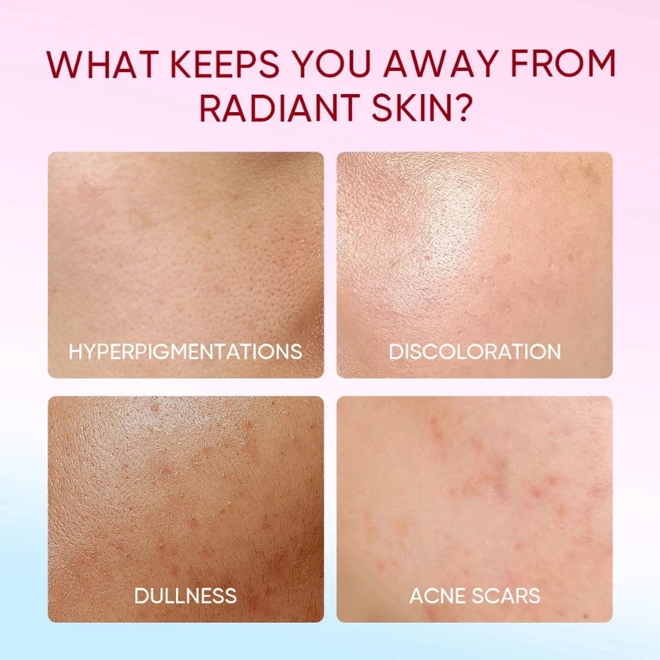 Brightening Facial Cream – Niacinamide & Tranexamic Acid Moisturizer