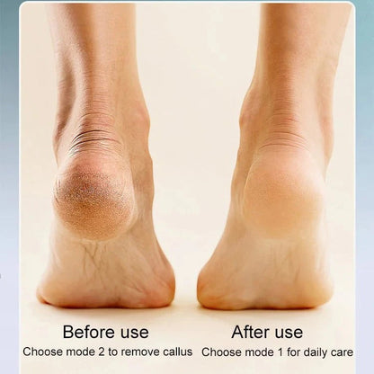 Rechargeable Electric Foot Callus Remover – Smooth & Soft Feet at Home