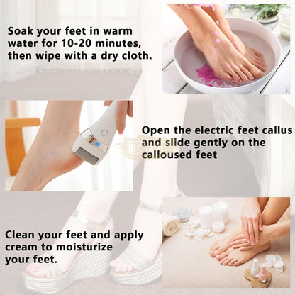 Rechargeable Electric Foot Callus Remover – Smooth & Soft Feet at Home